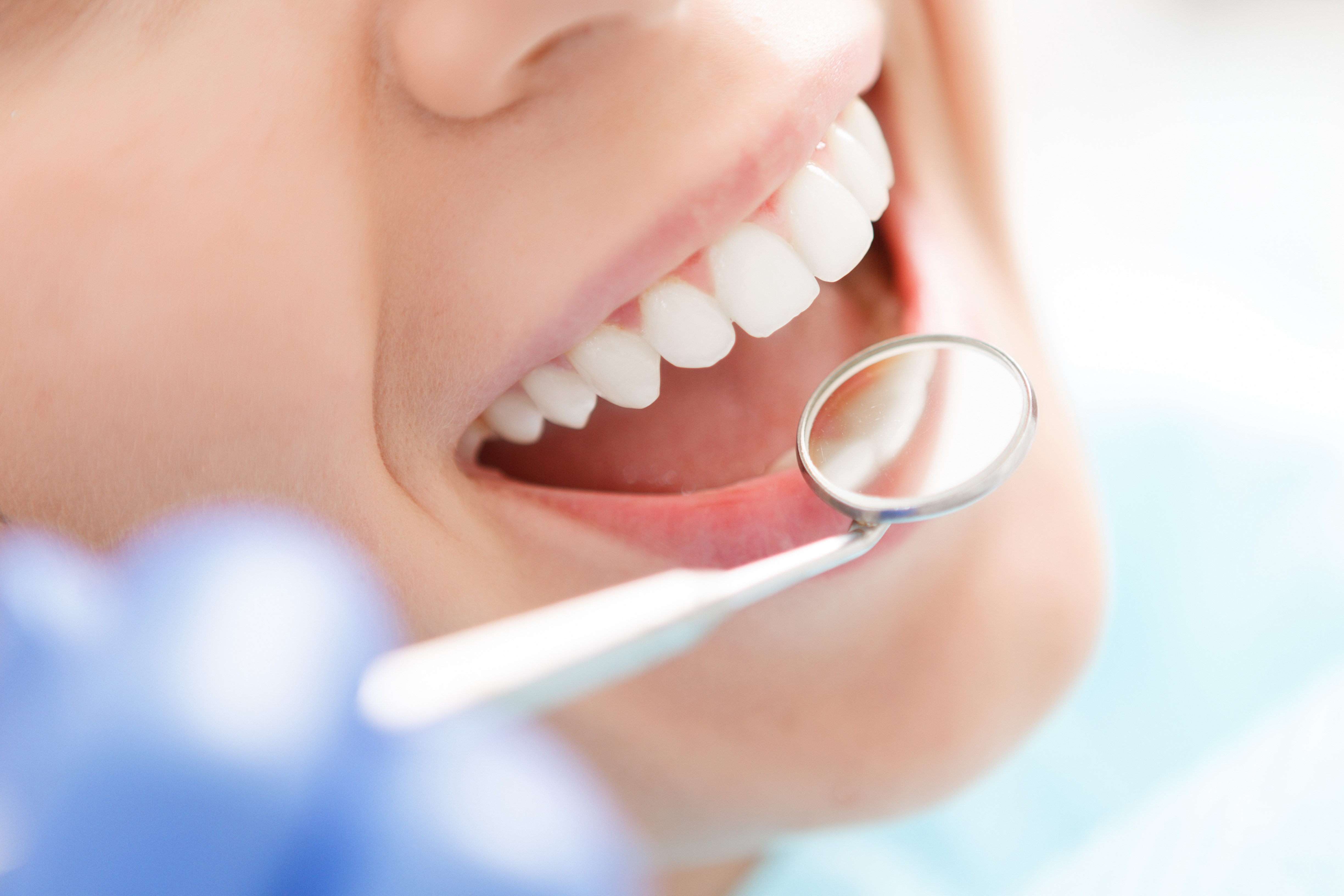 Simplifying Esthetic Composite Reconstructions Using CLEARFIL Majesty™ ES-2 Universal