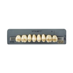 Vita MFT Upper, Posterior, Shade 3M1, Mould PU33