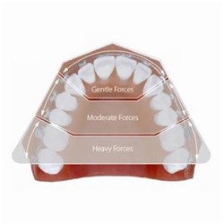 NAOL Variable Force 3 Proform Archwire, 019X025 Lower, 10-Pack