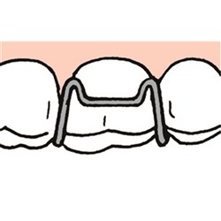 NAOL Adam Clasps, 7mm (100)