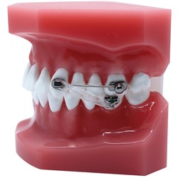 NAOL D2 Appliance - Metal (Set Of 2 Arms)