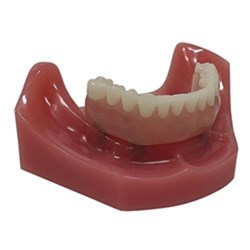 LOCATOR FIXED Patient Education Model