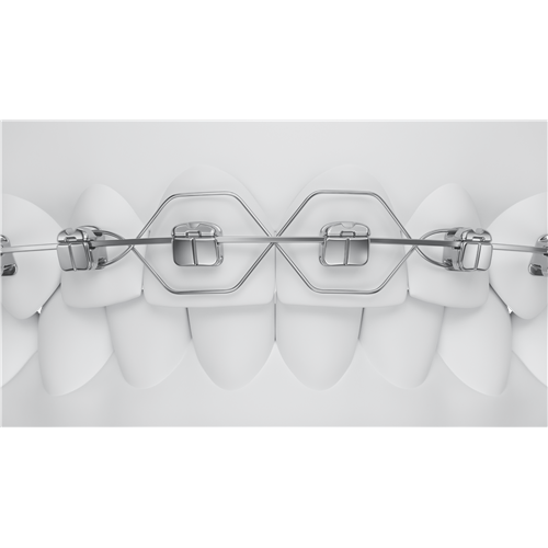 O2-102-04U21_4