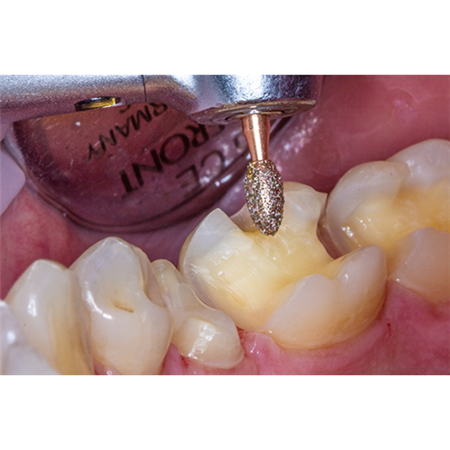 PREP_20201109_005_KP6379_DIAO_drbenz_701-1077