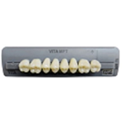 Vita MFT Upper, Anterior, Classical Shade A1, Mould T41