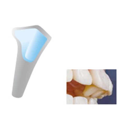 NAOL Mini-Mold 7mm Anterior Bite Jet, 8-Pack