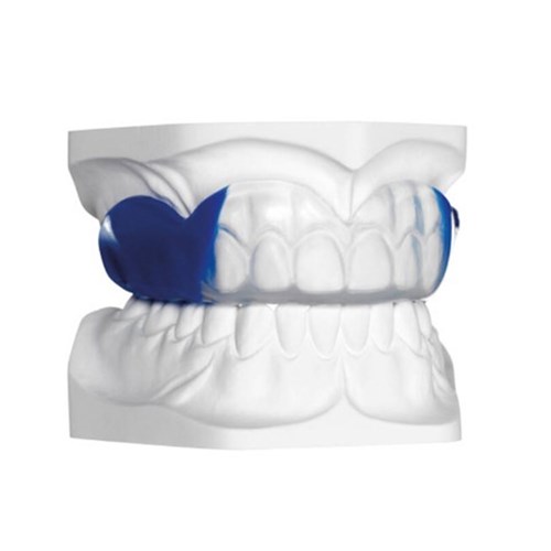Scheu Bioplast Xtreme Kit - 125 x 5.0mm - Blue - Round, 1-Pack
