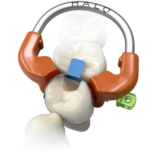 Ultradent Halo Sectional Matrix Kit - Original Bands - No Instruments