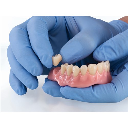 Vita VIONIC VIGO - Posterior - Shade A1, Mould 23L - UK Lower