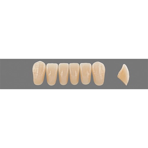 2M3 Lower L41 Anterior