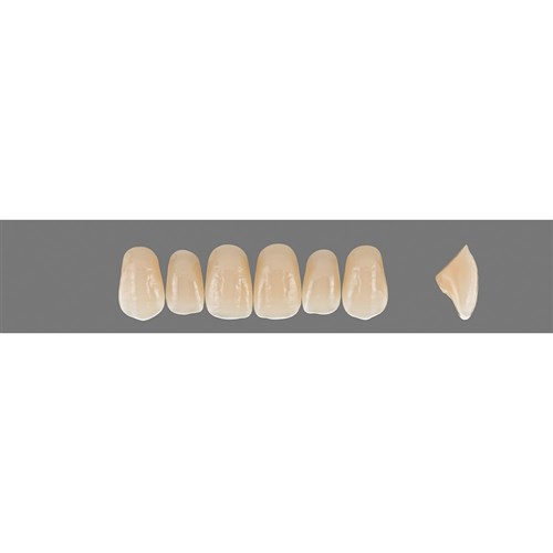 2M3 Upper O41 Anterior