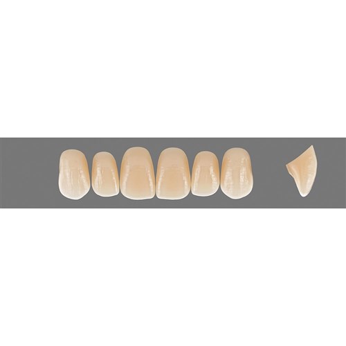 2M3 Upper O47 Anterior