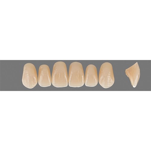 2M3 Upper O51 Anterior