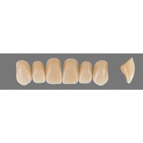 2M3 Upper T54 Anterior