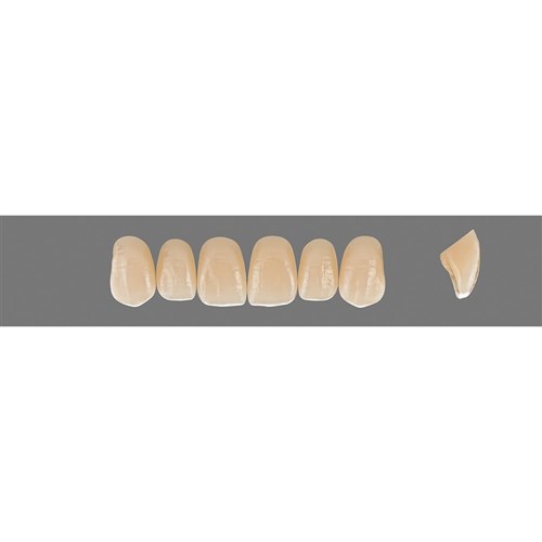 2R2.5 Upper O43 Anterior